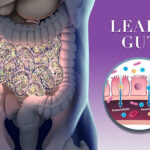 Unveiling the Secret Ingredients in Top Leaky Gut supplements